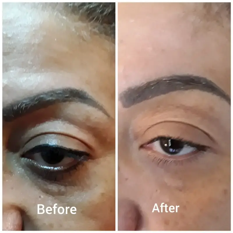 Dr Jamal Johnston in his dental clinic is giving a young woman high intensity focused treatment